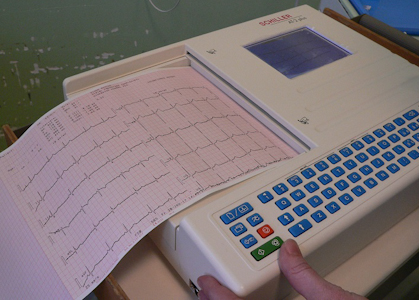 , Chirurgické oddelenie žilinskej nemocnice získalo nový EKG prístroj